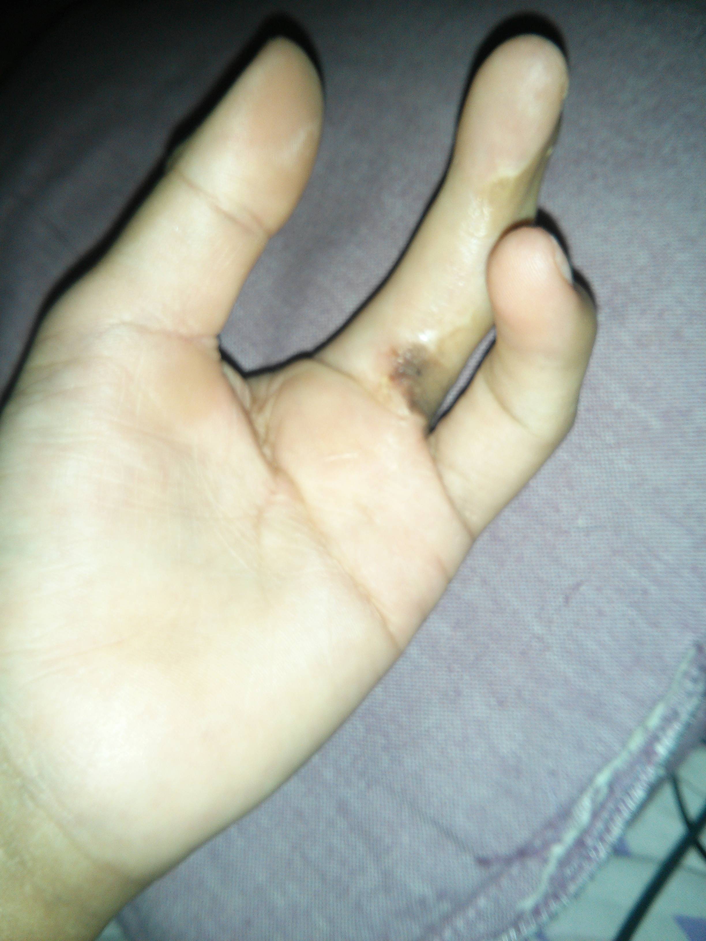 hand